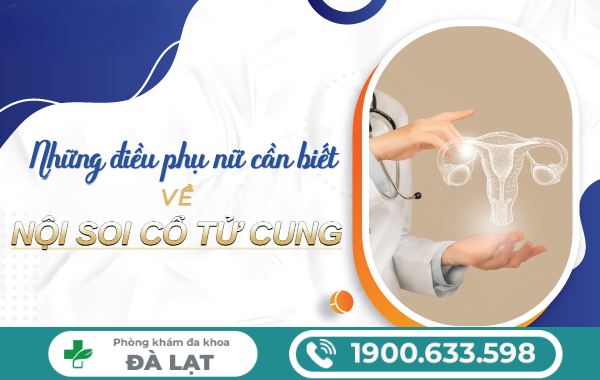 Hình ảnh minh họa